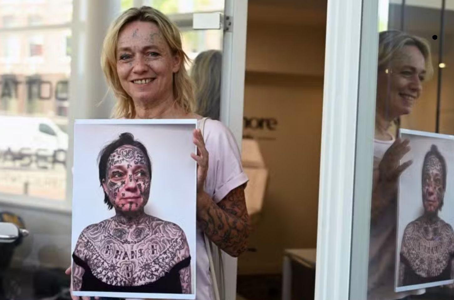 Após anos de violência, mulheres removem tatuagens feitas à força e recuperam a própria autoestima na Holanda