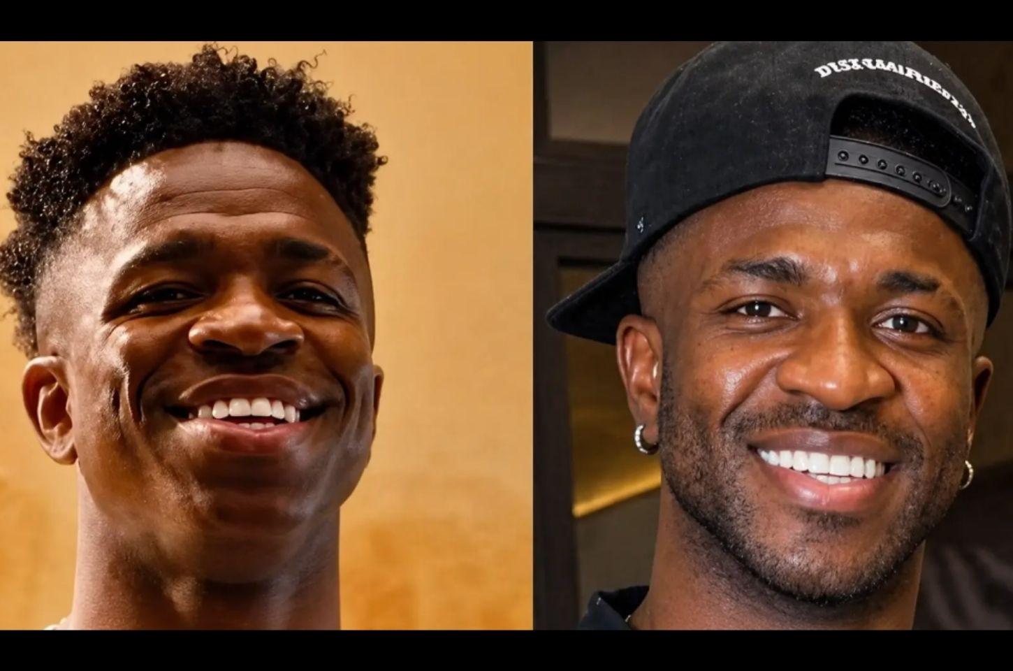 Jogadores recorrem à harmonização facial para fortalecer imagem dentro e fora dos gramados